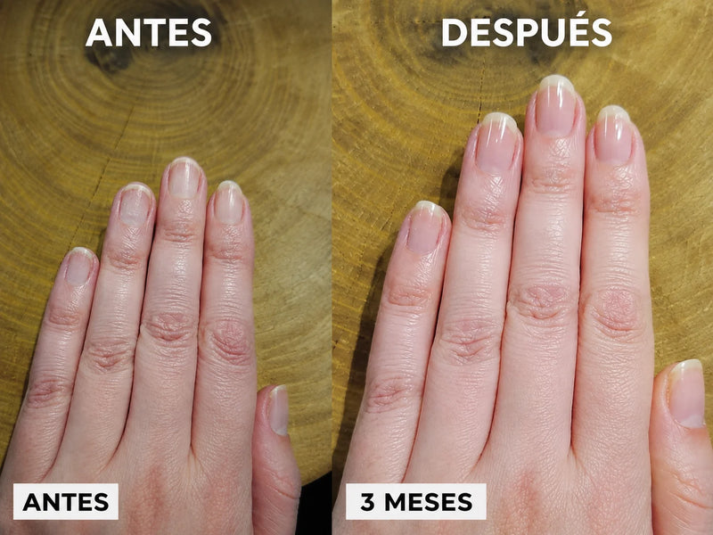 UÑAS QUE SE ROMPEN ANTES DE CRECER